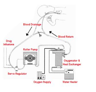 ECMO circuit (roller pump)